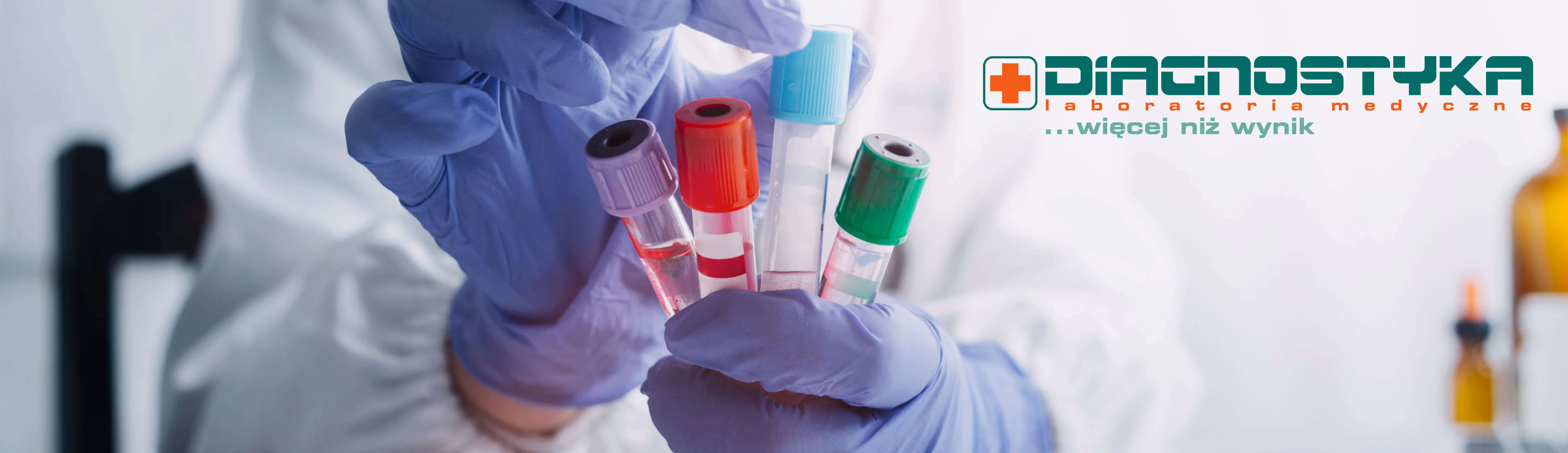 Diagnosta trzyma probówki. Punkt Pobrań - Diagnostyka